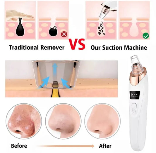 RA  Acne Pore Cleaner & Black Head Remo